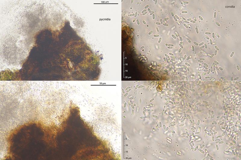 macrostoma