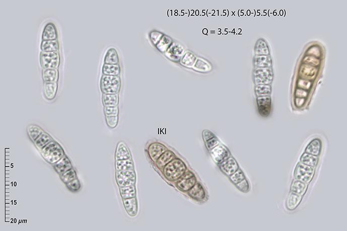 macrostoma