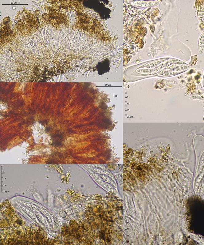 macrostoma