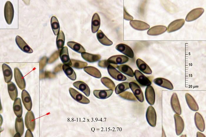 macrostoma
