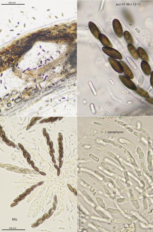 macrostoma