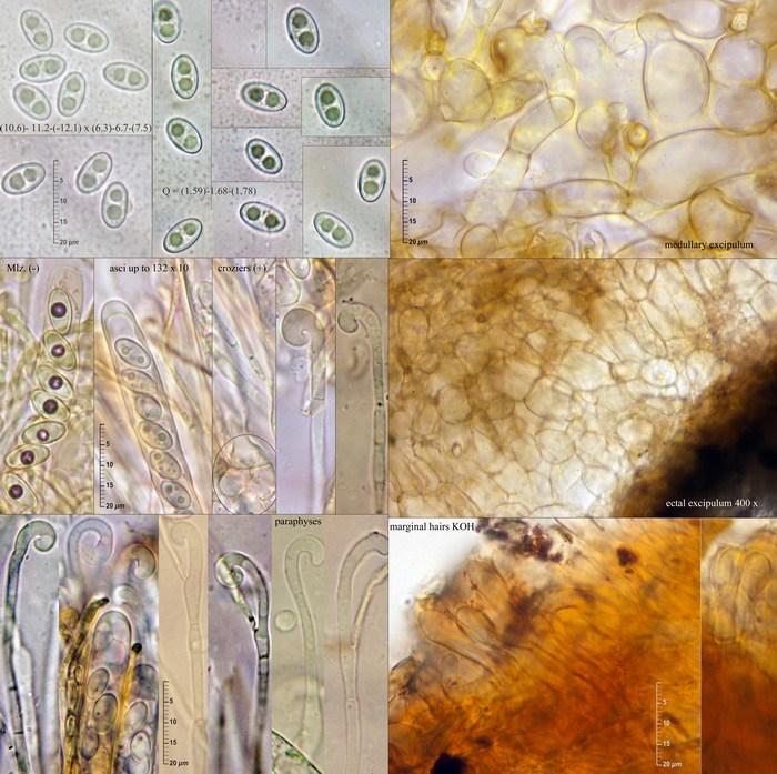 macrostoma
