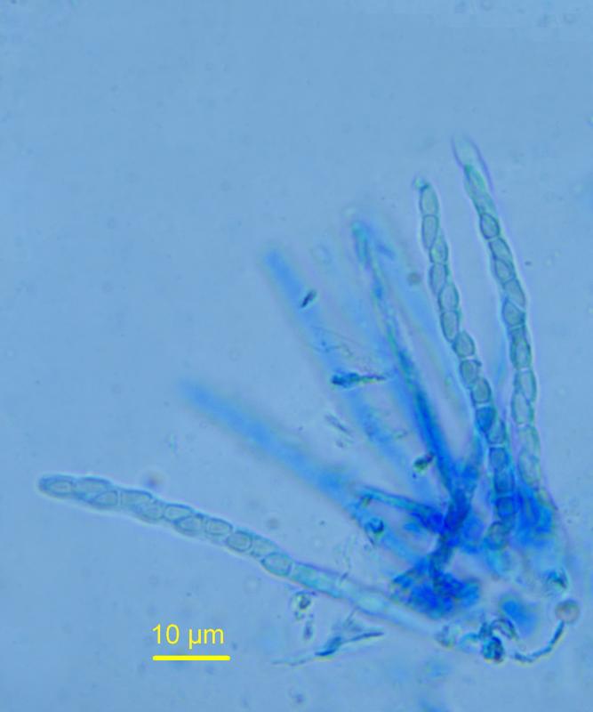 macrostoma
