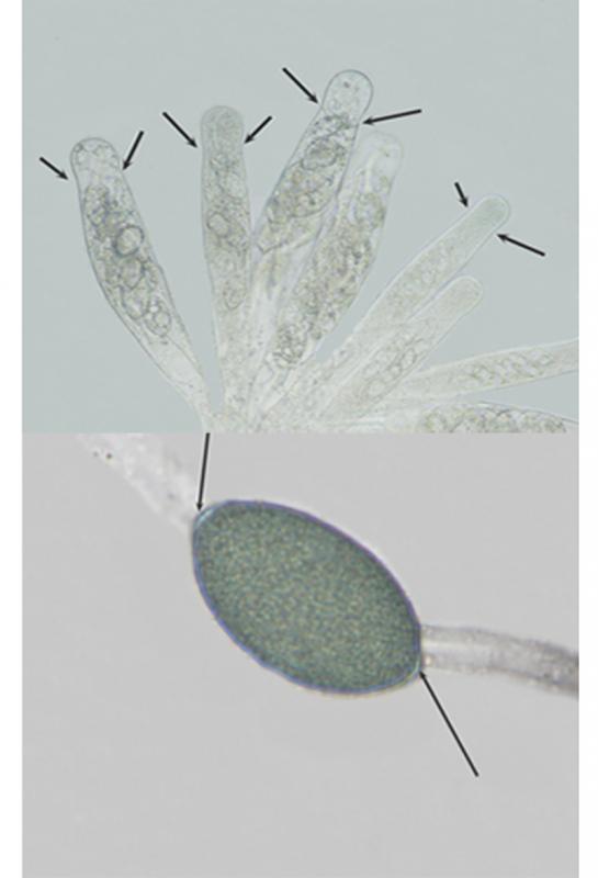 macrostoma