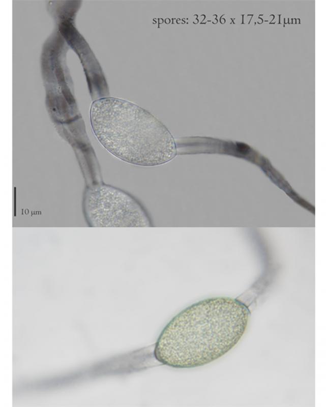 macrostoma