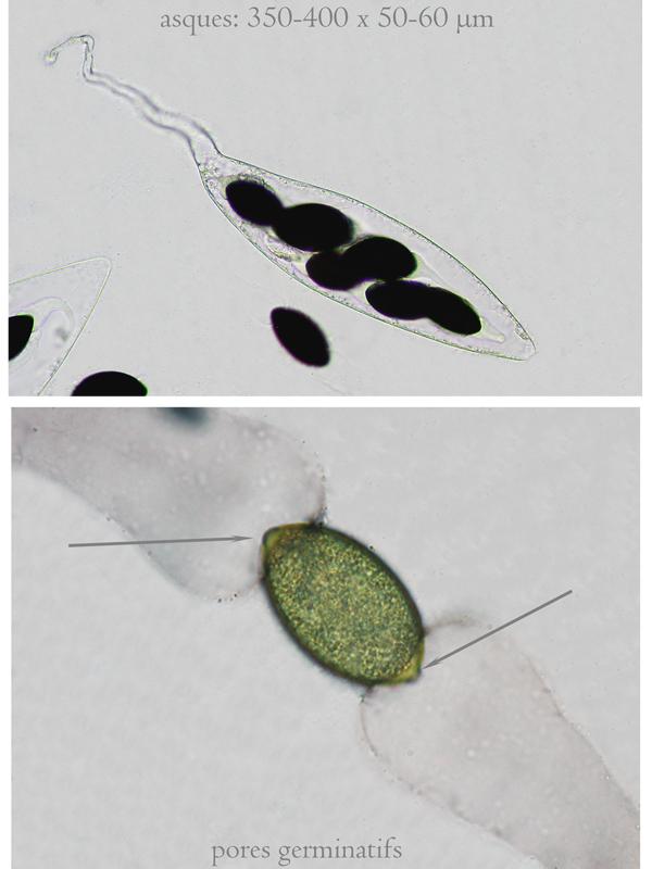 macrostoma