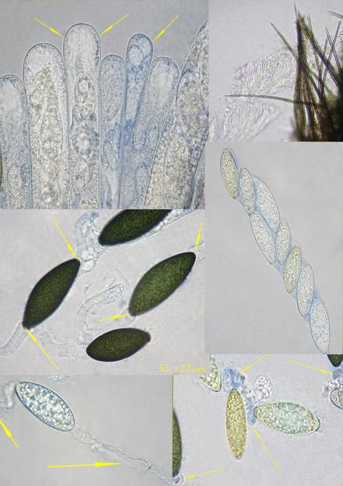 macrostoma