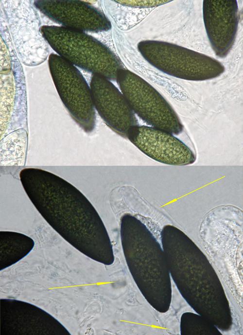 macrostoma