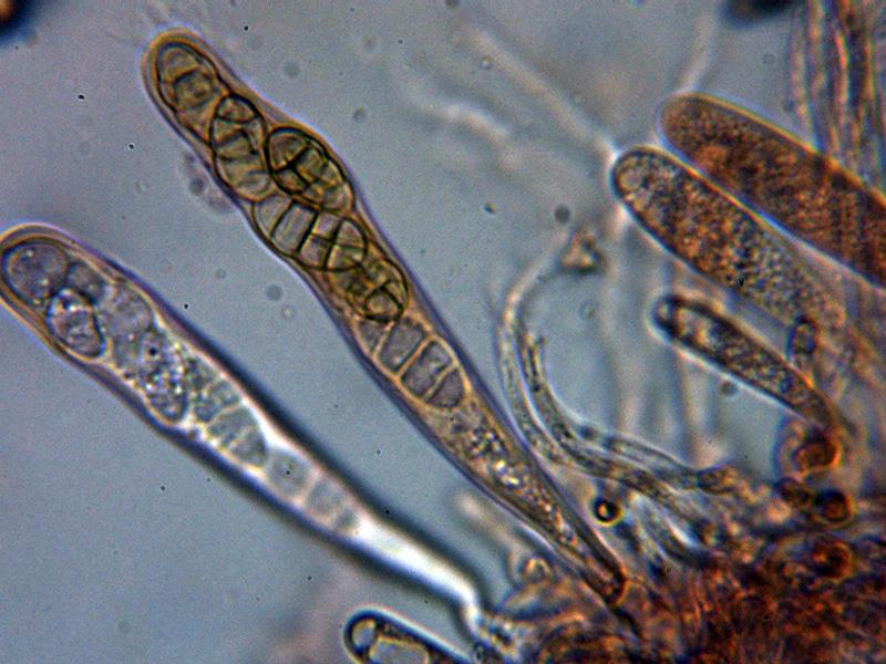 macrostoma