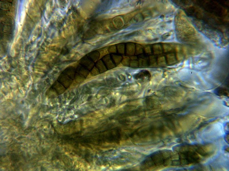 macrostoma