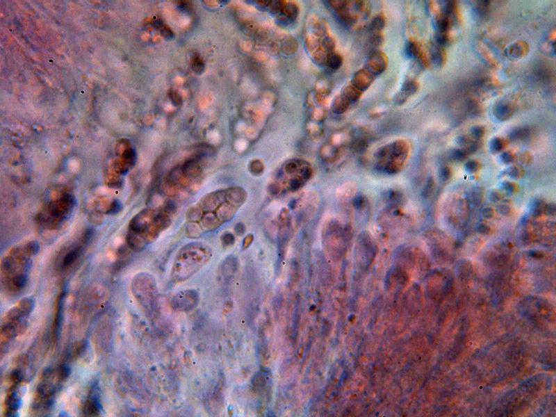 macrostoma