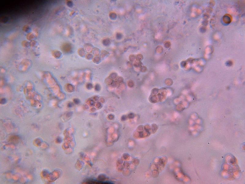 macrostoma