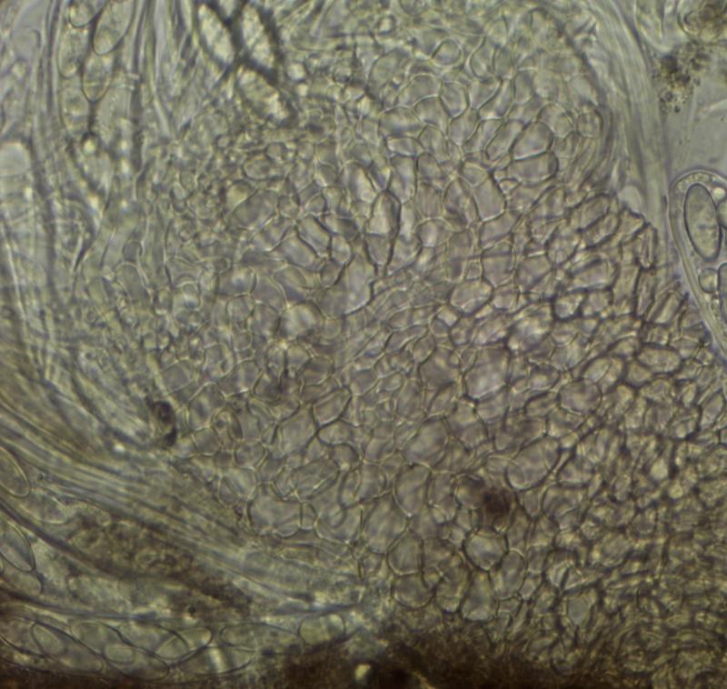 macrostoma