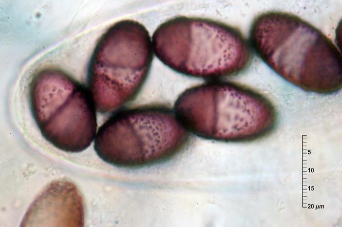 macrostoma