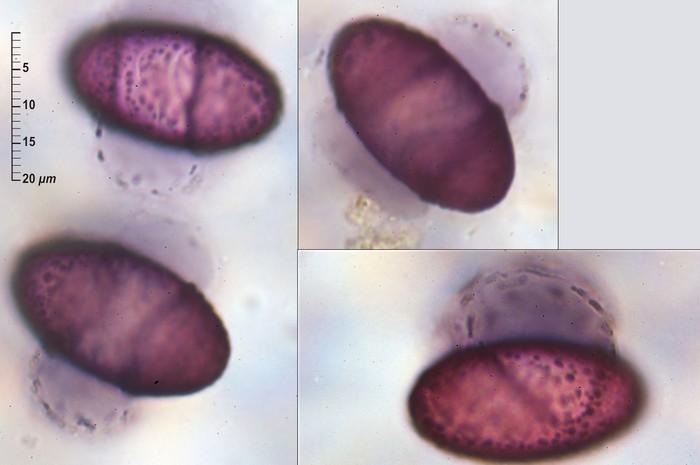 macrostoma