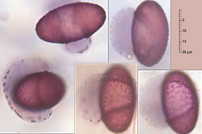 macrostoma