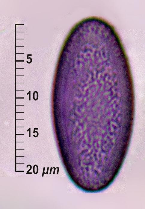 macrostoma