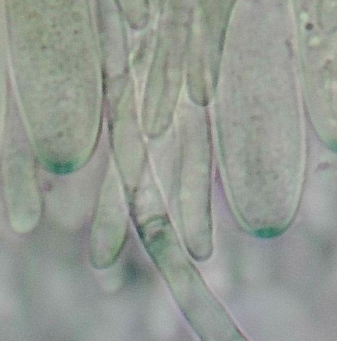 macrostoma