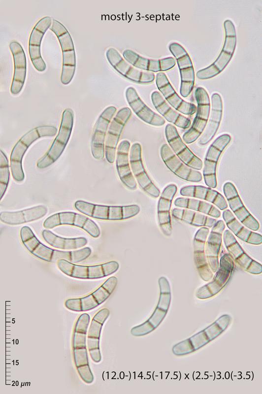 macrostoma