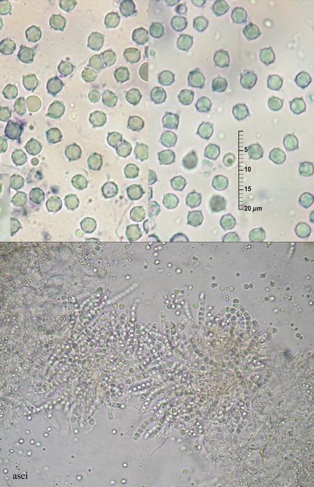macrostoma