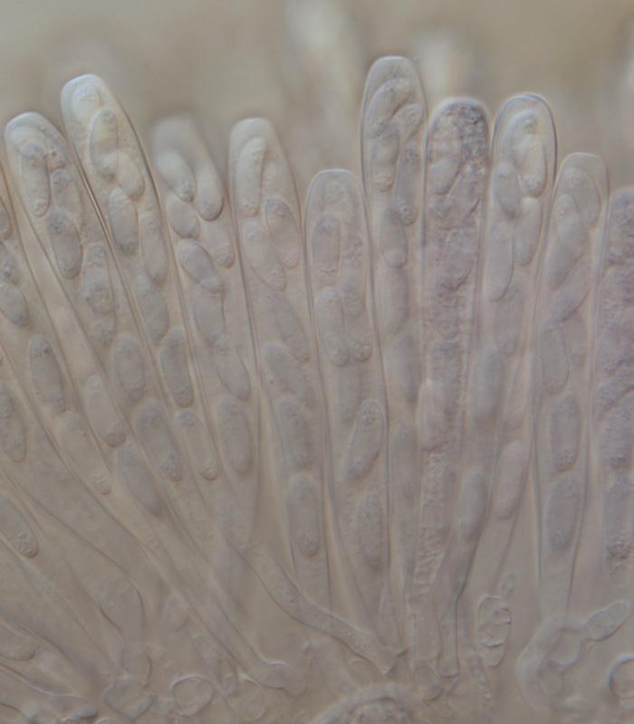 macrostoma