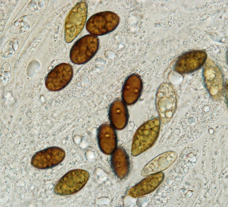 macrostoma