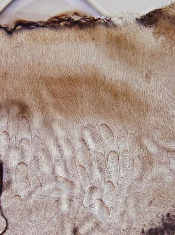 macrostoma