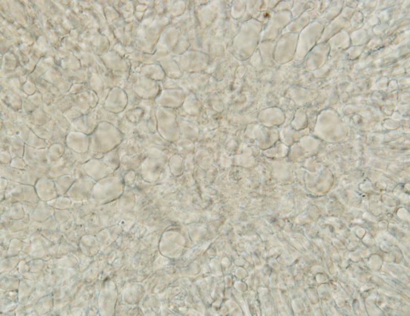 macrostoma
