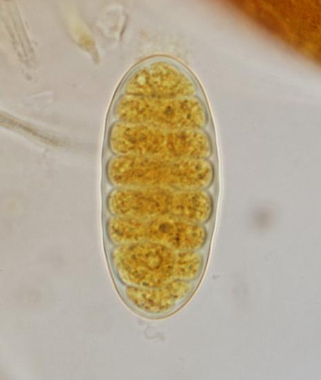 macrostoma
