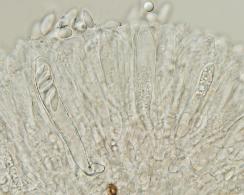 macrostoma