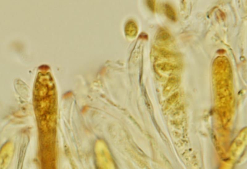 macrostoma