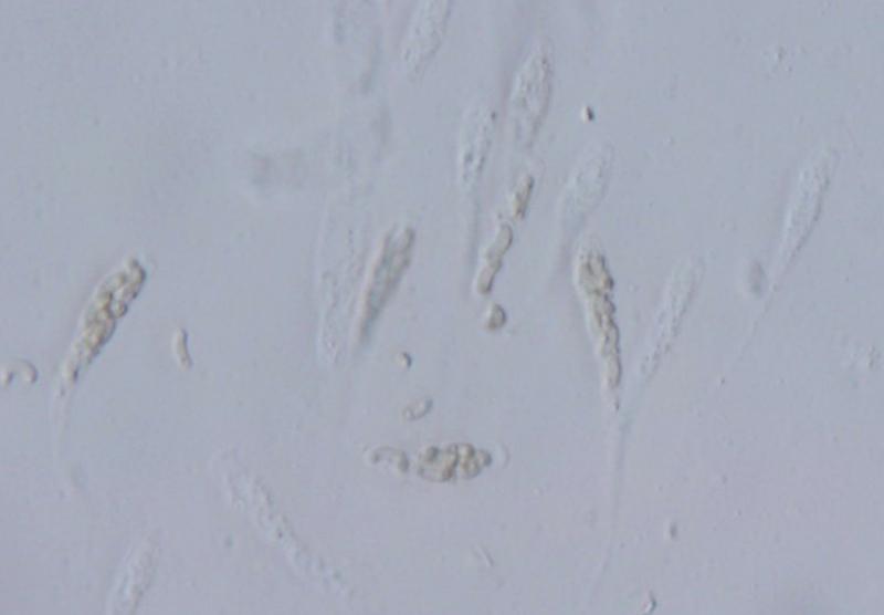 macrostoma