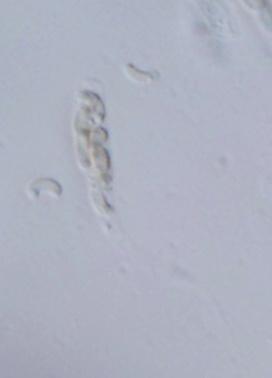 macrostoma