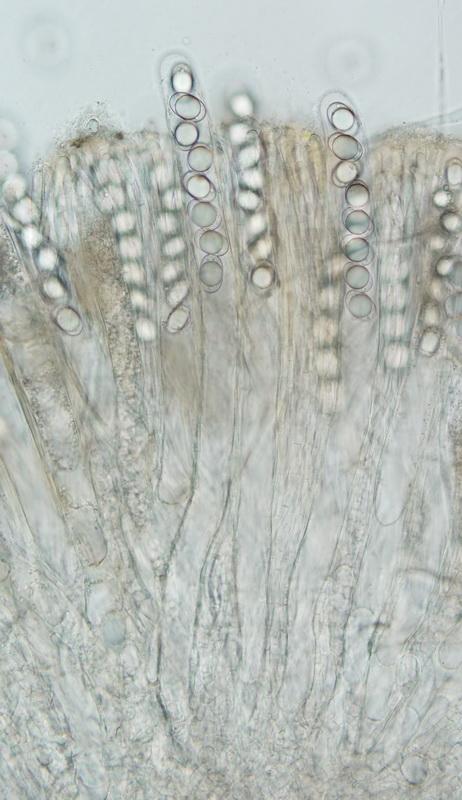 macrostoma