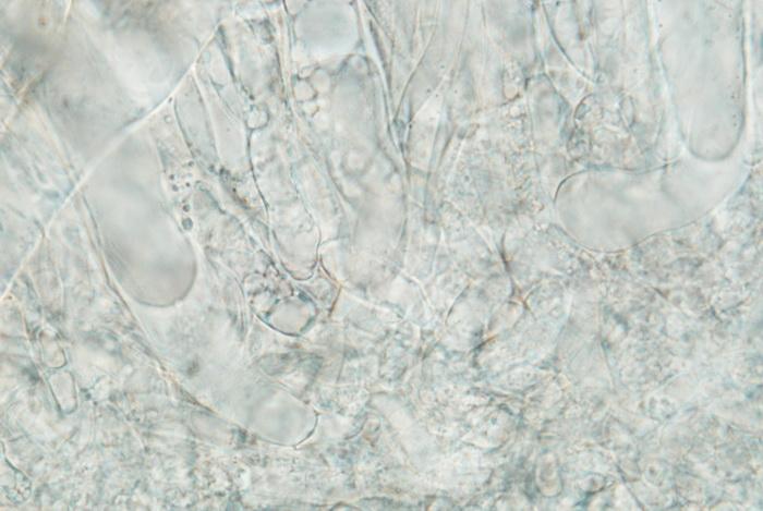 macrostoma