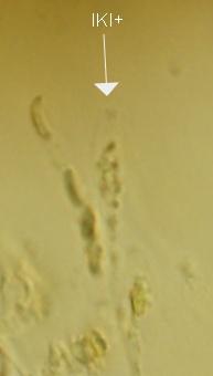 macrostoma