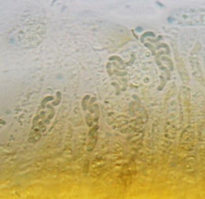 macrostoma