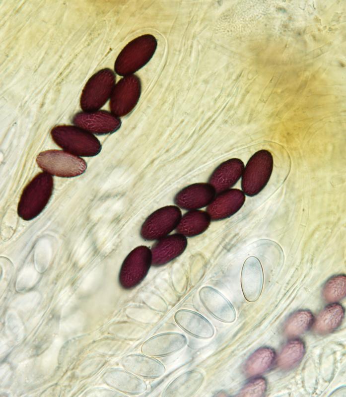 macrostoma