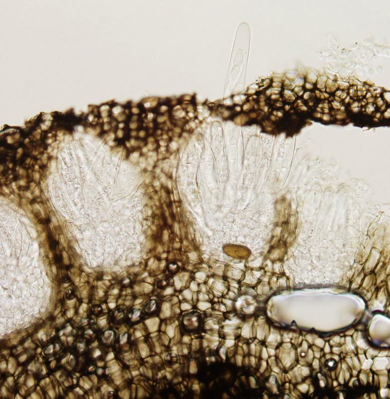 macrostoma