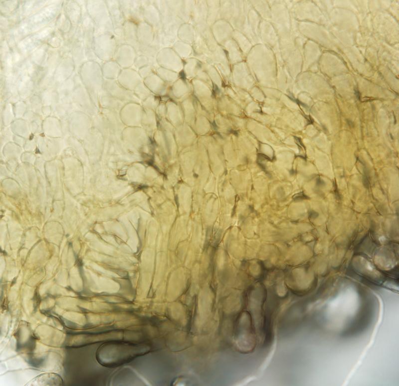 macrostoma