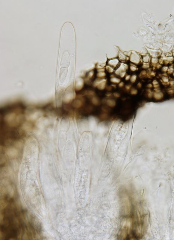 macrostoma