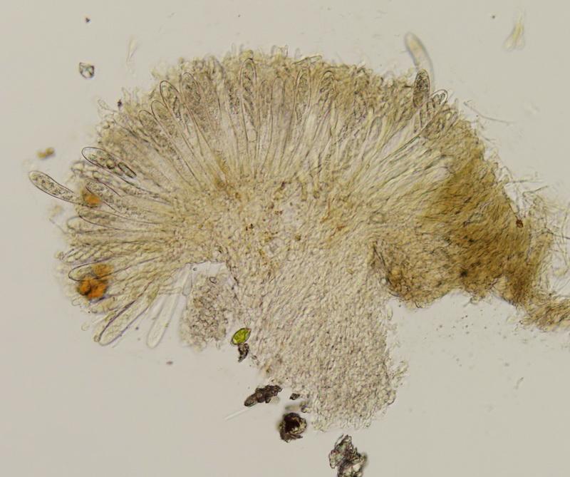 macrostoma