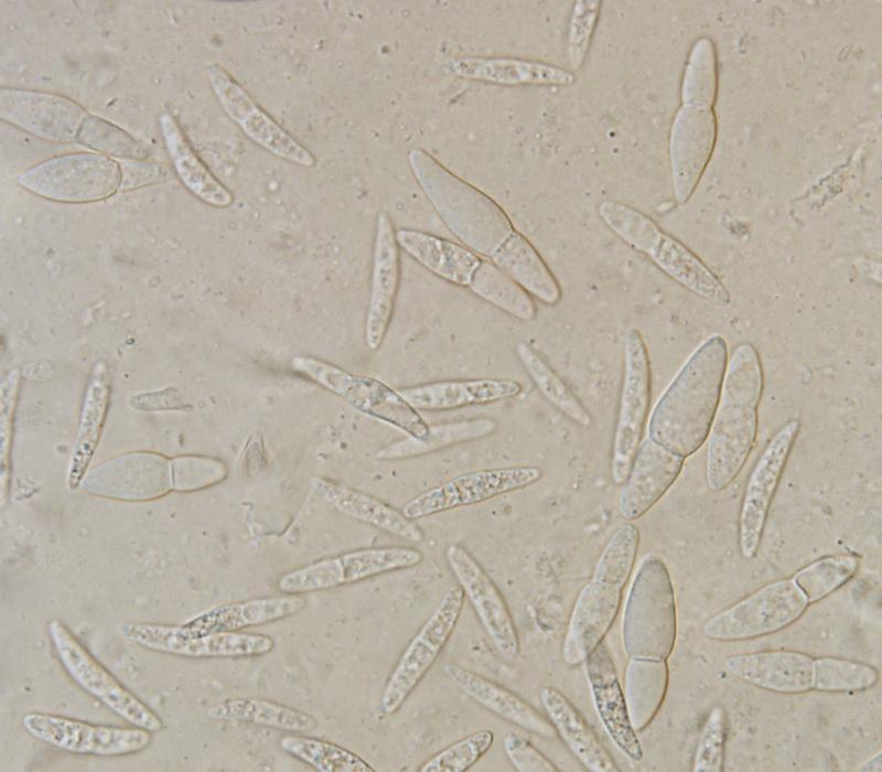 macrostoma