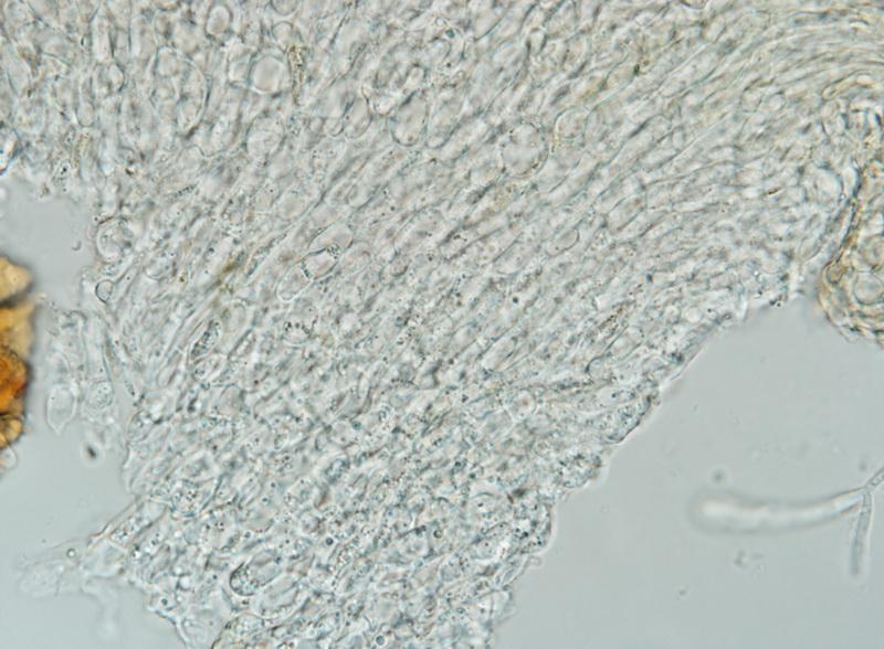 macrostoma