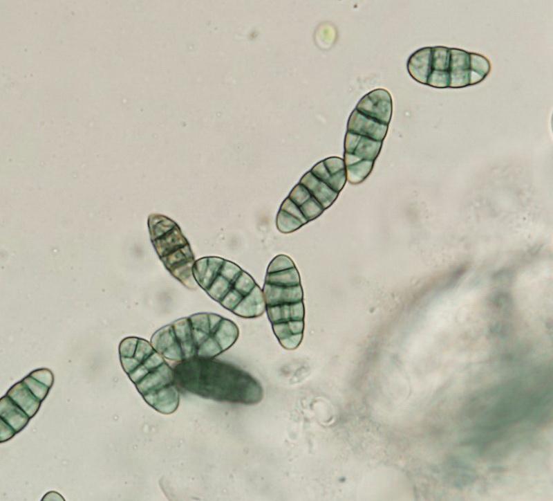 macrostoma