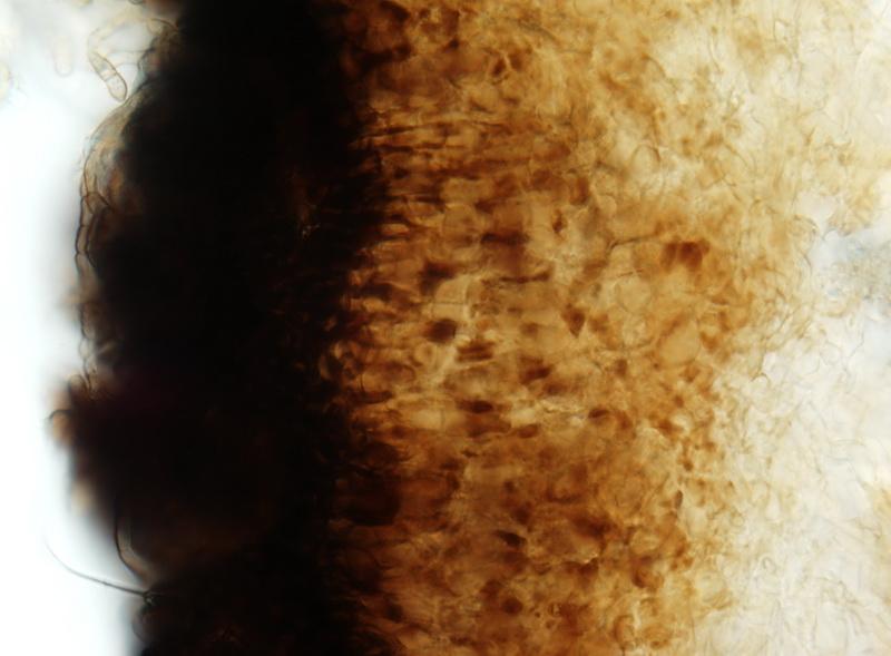 macrostoma