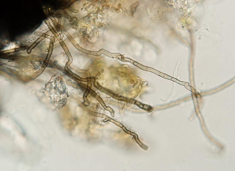 macrostoma