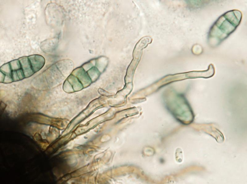 macrostoma