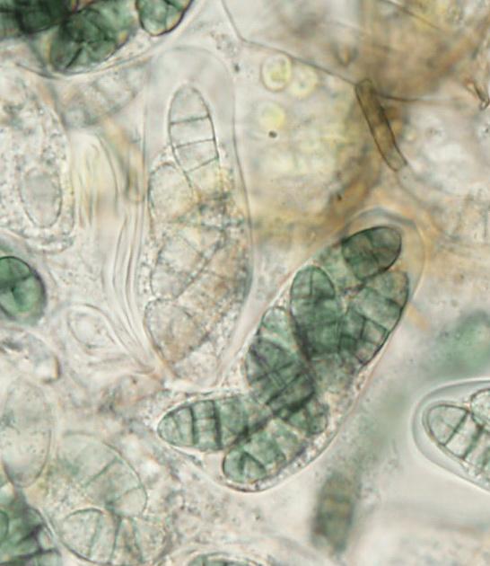 macrostoma