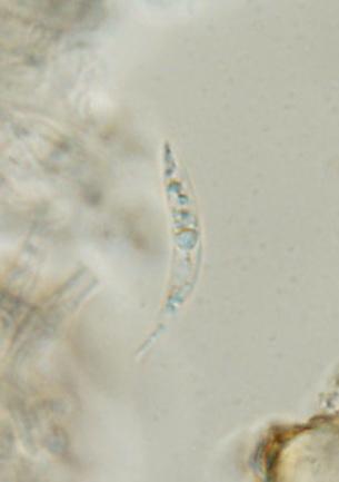 macrostoma